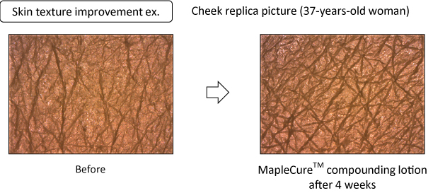 Skin texture improvement ex.